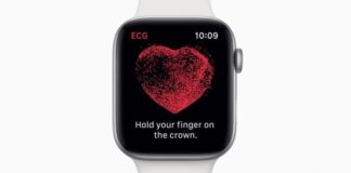 apple watch 4 ecg 796x419